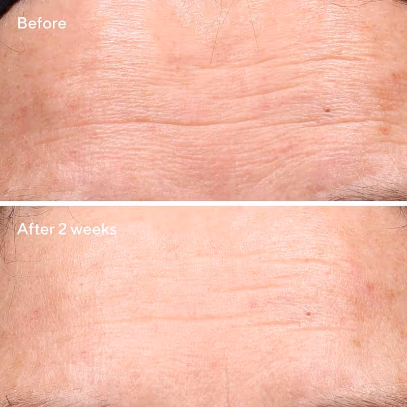 سرم جوانسازی رتینول دکتر مورد murad retinol