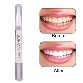 مداد سفیدکننده دندان دزلینگ وایت Dazzling White Instant Teeth Whitening