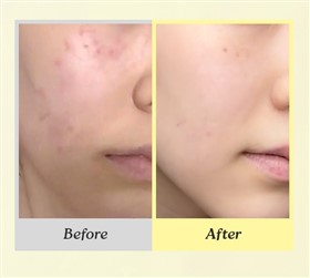 کرم ترمیم کننده و التیام بخش دکتر التیا Dr Althea 345 Relief حجم 50 میلی لیتر