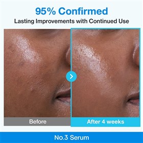 سرم کوچک کننده منافذ پوست نامبوزین بلو رتینول Numbuzin Blue Bio Retinol حجم 30 میلی لیتر