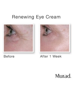 کرم نوسازی دور چشم رتینول دکتر مورد Murad Renewing Eye Cream حجم 15 میلی لیتر