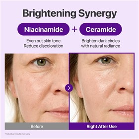 کرم ضدچروک و روشن کننده دور چشم نامبوزین Numbuzin NAD Retinol حجم 20 میلی لیتر
