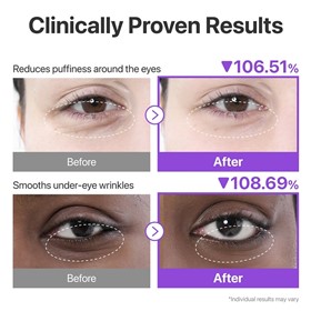 پچ زیر چشم نامبوزین Numbuzin N9 NAD تعداد 5 جفت