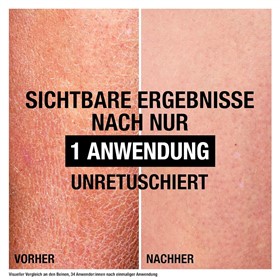 کرم مرطوب کننده قوی بدن نوتروژنا Neutrogena Yogun Nemlendirici حجم 200 میلی لیتر